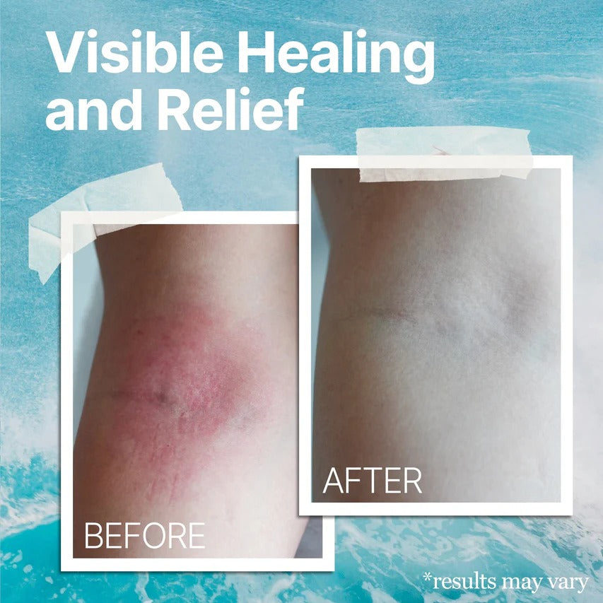 Natural Soothing Cream - Sea Moss Colloidal Oats - for Eczema Psoriasis Prone Skin - Minerals from The Sea - for Sensitive Skin - Hydrating Eczema Cream for Dry Skin (4 Oz)