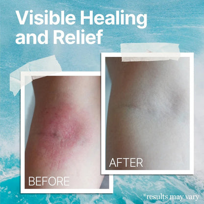 Natural Soothing Cream - Sea Moss Colloidal Oats - for Eczema Psoriasis Prone Skin - Minerals from The Sea - for Sensitive Skin - Hydrating Eczema Cream for Dry Skin (4 Oz)
